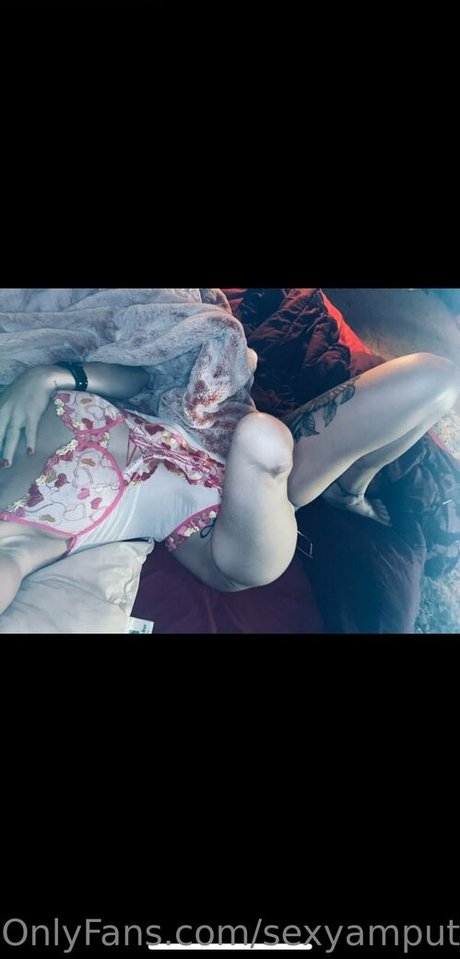 Sexyamputee
