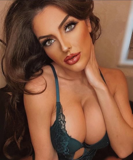 Misskayleighrosedematos