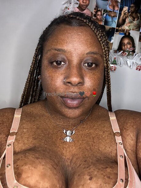 Freckledfantasy5