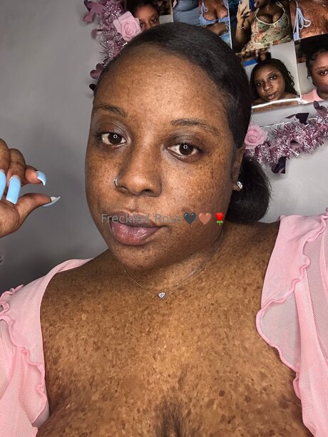 Freckledfantasy5