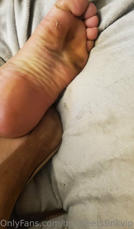 Missfeetstinkvip