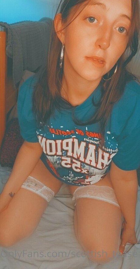 Scottishtease