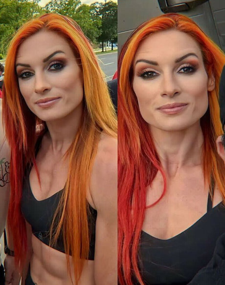 Becky Lynch