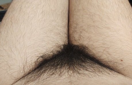 Hairy Women