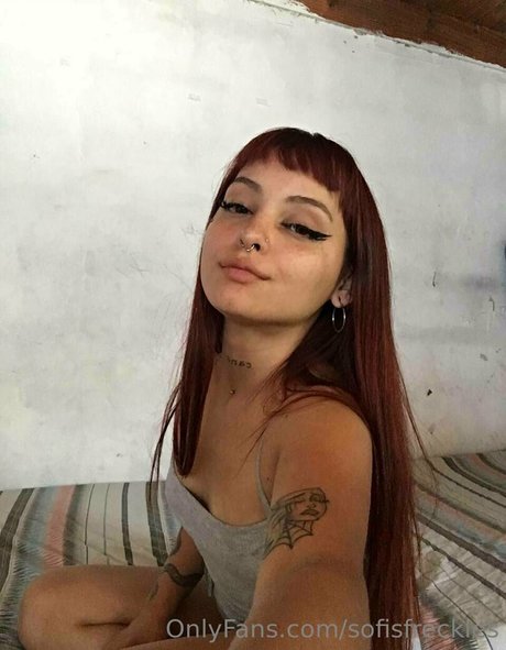 Sofisfreckles