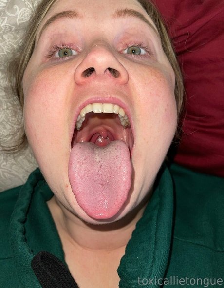 Toxicallietongue